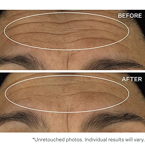 StriVectin Wrinkle Recode Line Transforming Melting Serum, 1 Fl Oz