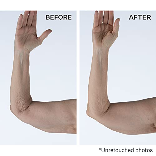 StriVectin Tighten and Lift Crepe Control Tightening Body Cream for Firmer, Brighter Arms and Legs, 6.7 Fl Oz