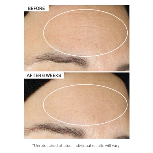 StriVectin Super-B Barrier Strengthening Oil with Vitamin B3 and Prebiotics, 1 Fl Oz