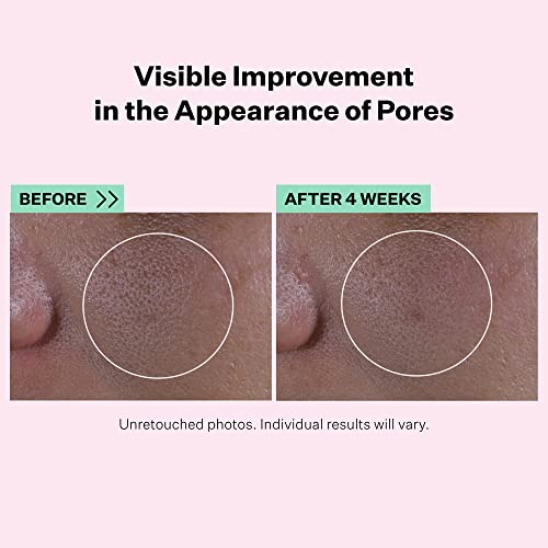 Multi-Action Super Shrink Pore Minimizing Serum for minimizing clogged pores and blackheads for tightening and brightening skin texture