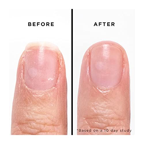 butter LONDON Orange Marmalade Jelly Preserve Strengthening Treatment, Orange, Nourishes Dry and Brittle Nails, Strengthens Weak Nails, Vitamin E and Tea Tree Oil, Gluten, Vegan and Cruelty Free