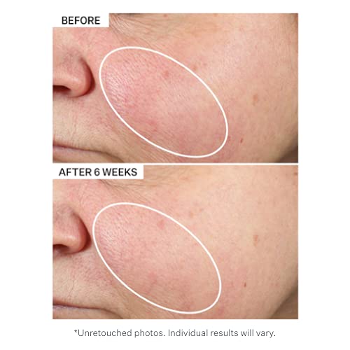 StriVectin Super-B Barrier Strengthening Oil with Vitamin B3 and Prebiotics, 1 Fl Oz