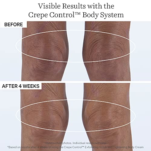 StriVectin Tighten and Lift Crepe Control Tightening Body Cream for Firmer, Brighter Arms and Legs, 6.7 Fl Oz